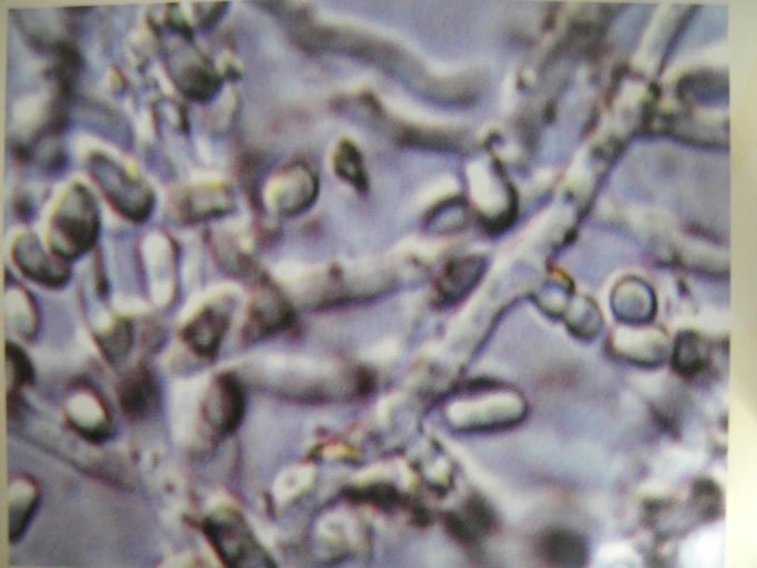 從菌塊上取樣用顯微鏡觀察，可見大部份菌絲已經分化（或轉型化)為分生孢子。
